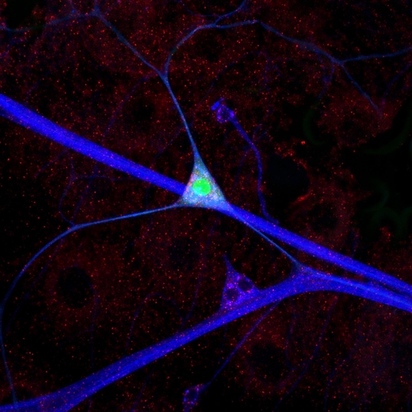 Pain Chronicles: Photomicrographs and Personal Stories