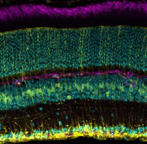 Peter Caradonna and UNE Histology Lab.
Layers of neurons highlighting the unique organization of the retina. CGRP+ bipolar neurons (yellow), NF200+ nerve fibers (magenta), cell nuclei (cyan). Confocal microscopy.